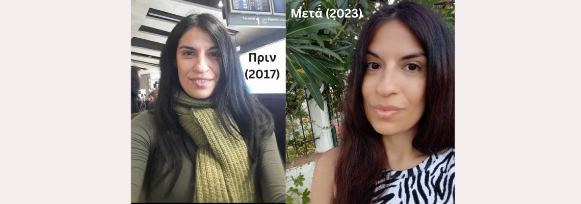 Περιποίηση Προσώπου στα 40 (Πριν και Μετά τα Προϊόντα Ομορφιάς MIELĒV)