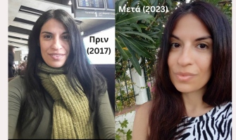 Περιποίηση Προσώπου στα 40 (Πριν και Μετά τα Προϊόντα Ομορφιάς MIELĒV)